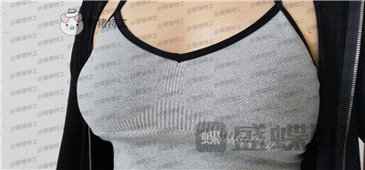 沧州华美,白伟枫,隆胸,案例,价格,