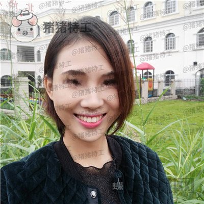 长沙美莱,斌,,案例,价格,