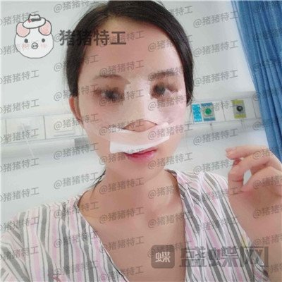长沙美莱,斌,,案例,价格,