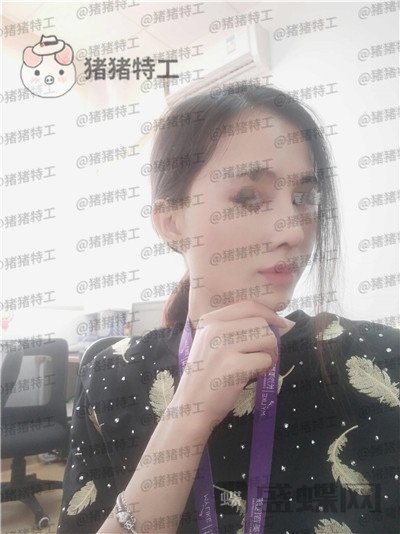 长沙美莱,斌,,案例,价格,