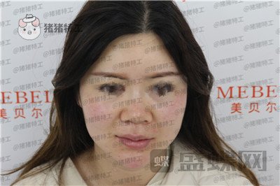 贵阳美贝尔,宋俊辉,,案例,价格,