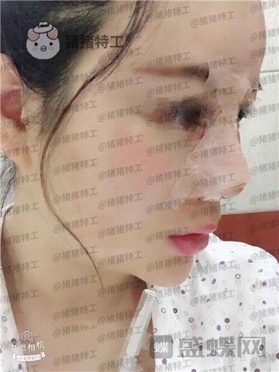 贵阳美贝尔,宋俊辉,,案例,价格,