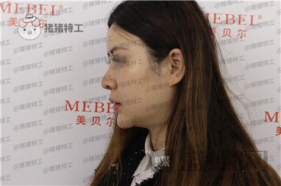 贵阳美贝尔,宋俊辉,,案例,价格,