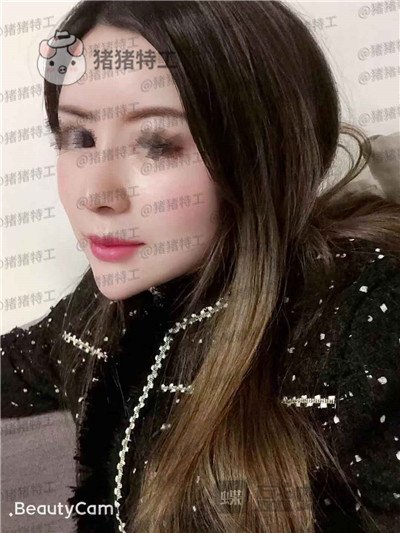 贵阳美贝尔,宋俊辉,,案例,价格,