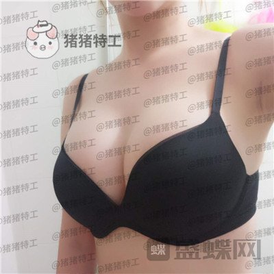 玛博尔,徐逸范,隆胸,案例,价格,