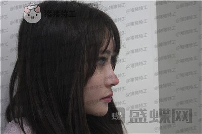 成都西区医院,肖凌,,案例,价格,