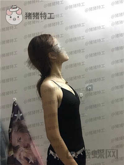 重庆新铜雀台,鹏,隆胸,案例,价格,