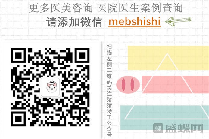 双下巴,双下巴吸脂,注意事项,