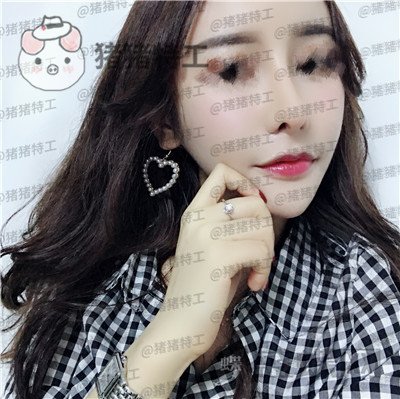 成都军大,文科,,隆鼻,案例,价格,