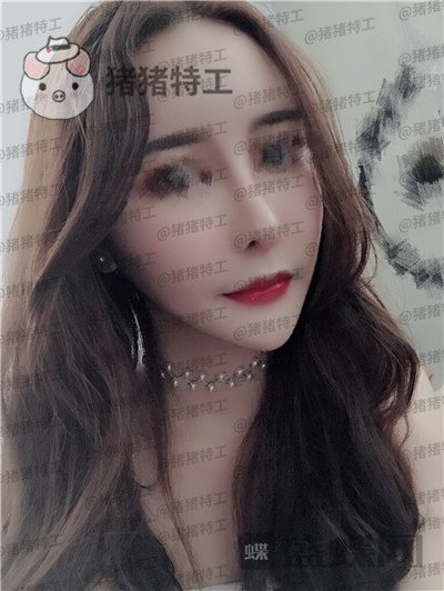 成都军大,文科,,隆鼻,案例,价格,