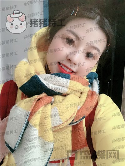 广州曙光,蒋思军,,隆鼻,案例,价格,