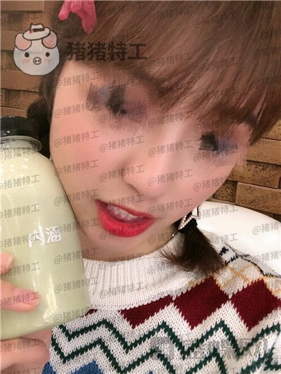 广州曙光,蒋思军,,隆鼻,案例,价格,