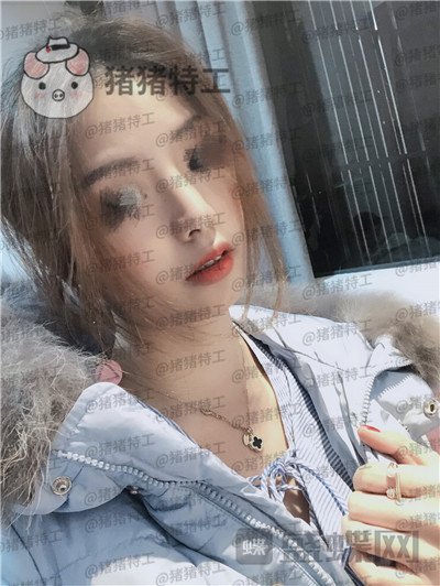 广州曙光,蒋思军,,隆鼻,案例,价格,