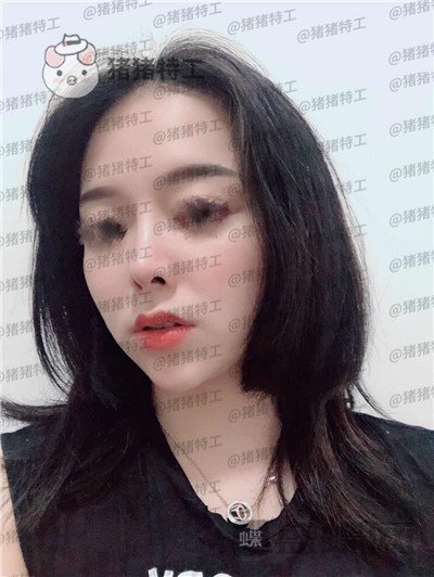 厦门福华,金贵香,,案例,价格,