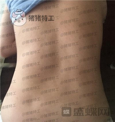 成都八大处,唐勇,吸脂,案例,价格,