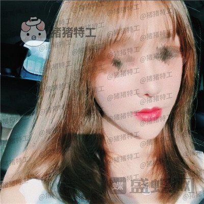 北京百达丽,上海九院硕士,苏婷,隆鼻,修复,案例,价格,