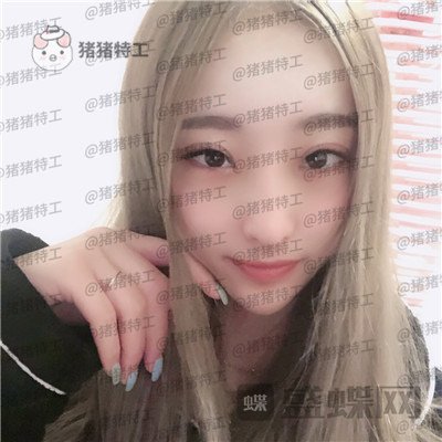 北京润美玉之光,王明利,面部填充,案例,价格,