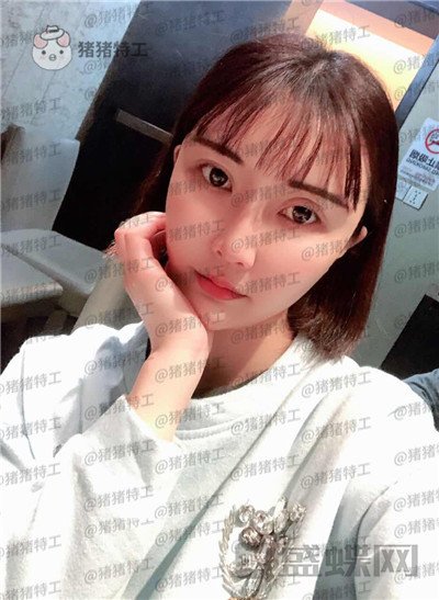 北京玲珑梵宫,张殿祥,面部填充,案例,价格,
