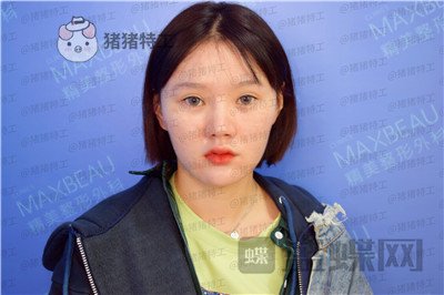 重庆精美,田永华,,案例,价格,