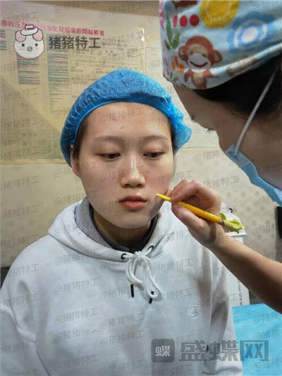长沙晶肤,朱苗,,案例,价格,