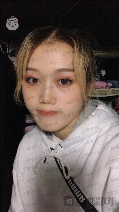 长沙晶肤,朱苗,,案例,价格,