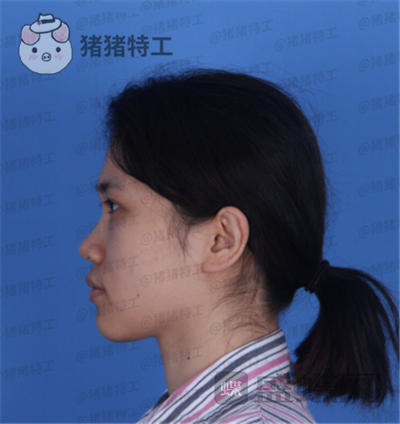 长春艾尔丽,赵广文,,案例,价格,