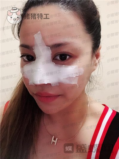 成都格莱丽,王伟,,案例,价格,