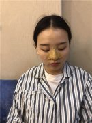 南宁悦星朱小平怎么样？价格案例分享