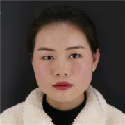 贵阳华美杜良军怎么样？价格案例分享