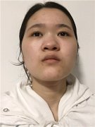 厦门颜施童晋文怎么样？案例分享