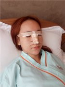 北京联合丽格师俊莉怎么样？案例分享