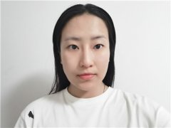 兰州亚韩医学李军梅怎么样？案例分享