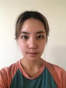 郑州芳艺杨伟怎么样？案例分享