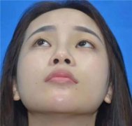 西安亚太谢劲松怎么样？案例分享