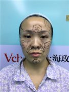 上海玫瑰邹功伟怎么样？案例分享