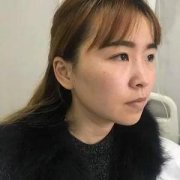 重庆军科乔少然眼怎么样？案例分享