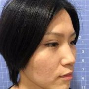 苏州康美陈勇怎么样？案例分享