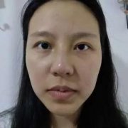 深圳南雅姚成红怎么样？案例分享