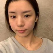 成都铜雀台雷刚怎么样？案例分享