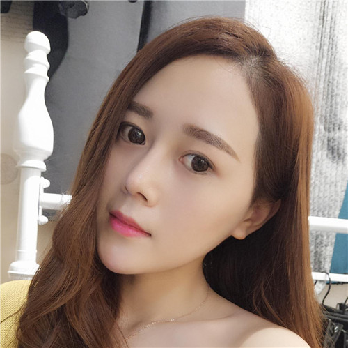 上海百达丽顾清肋软骨隆鼻怎么样？案例分享