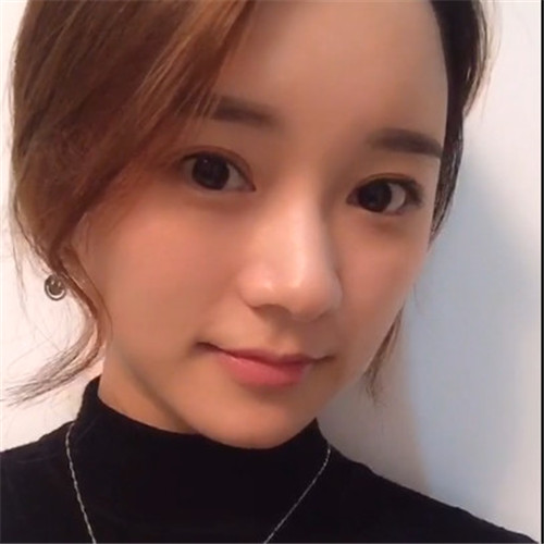 上海百达丽顾建成脂肪全脸填充怎么样？案例分享