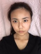 广东韩妃杨德发怎么样？价格案例分享