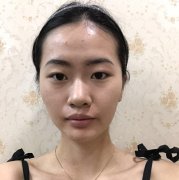 杭州艺星欧阳帆怎么样？价格案例分享