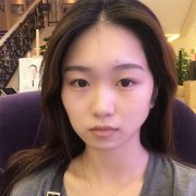 杭州维多利亚马腾自体脂肪全脸填充怎么样？价格案例分享