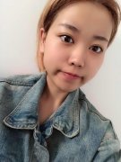 杭州华山连天美高俊明做颧骨颧弓怎么样？价格案例分享