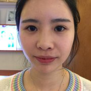 杭州华山连天美盛飞怎么样？价格案例分享