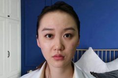 西安画美杨万忠怎么样？价格案例分享
