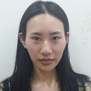 北京东方和谐孙泽芳自体脂肪隆胸怎么样？价格案例分享