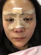 成都润美玉之光黄开亮怎么样？价格案例分享
