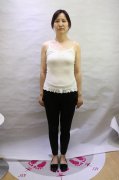 云南华美美莱夏国兴假体隆胸怎么样？价格案例分享